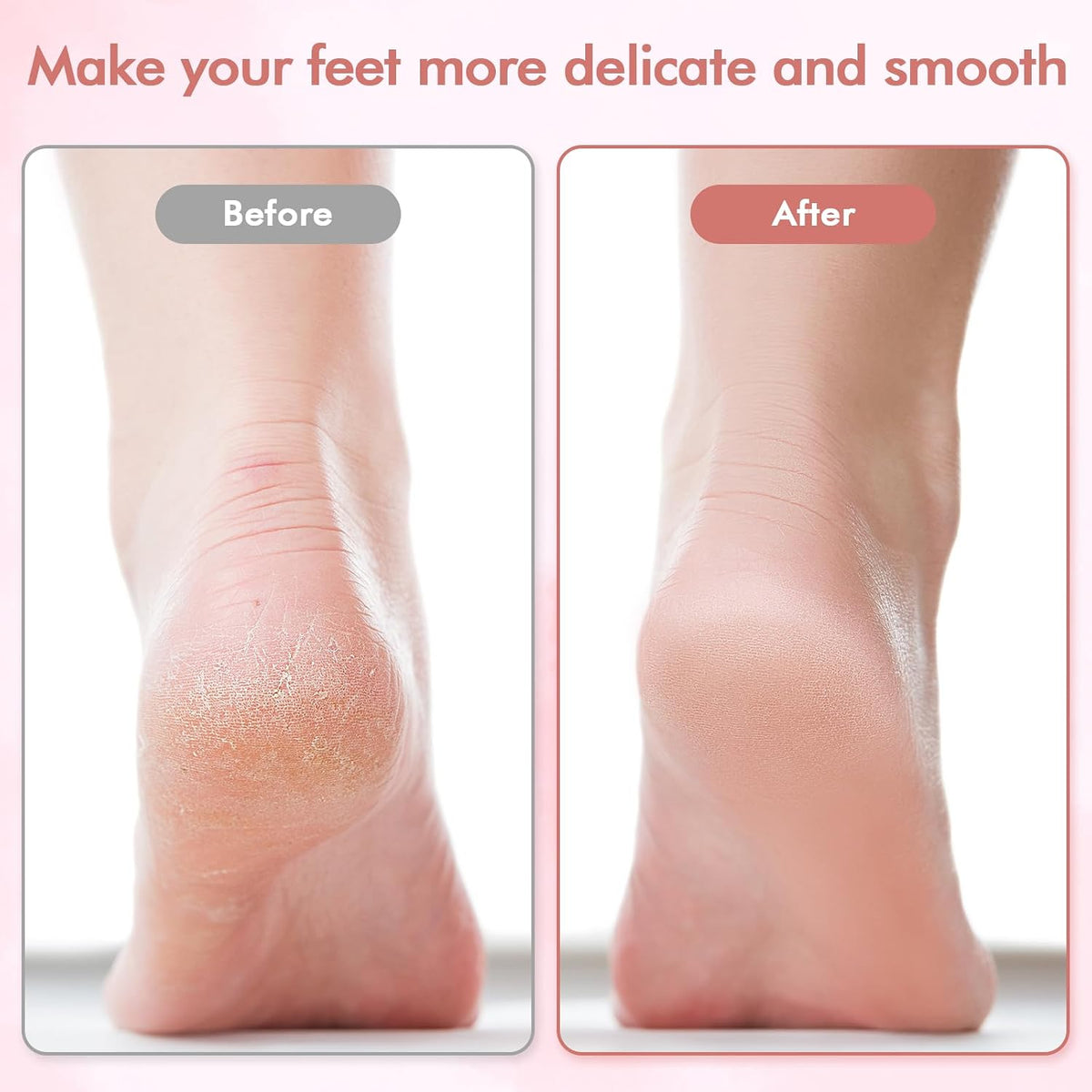 Electric Pedicure Foot File Callus Remover